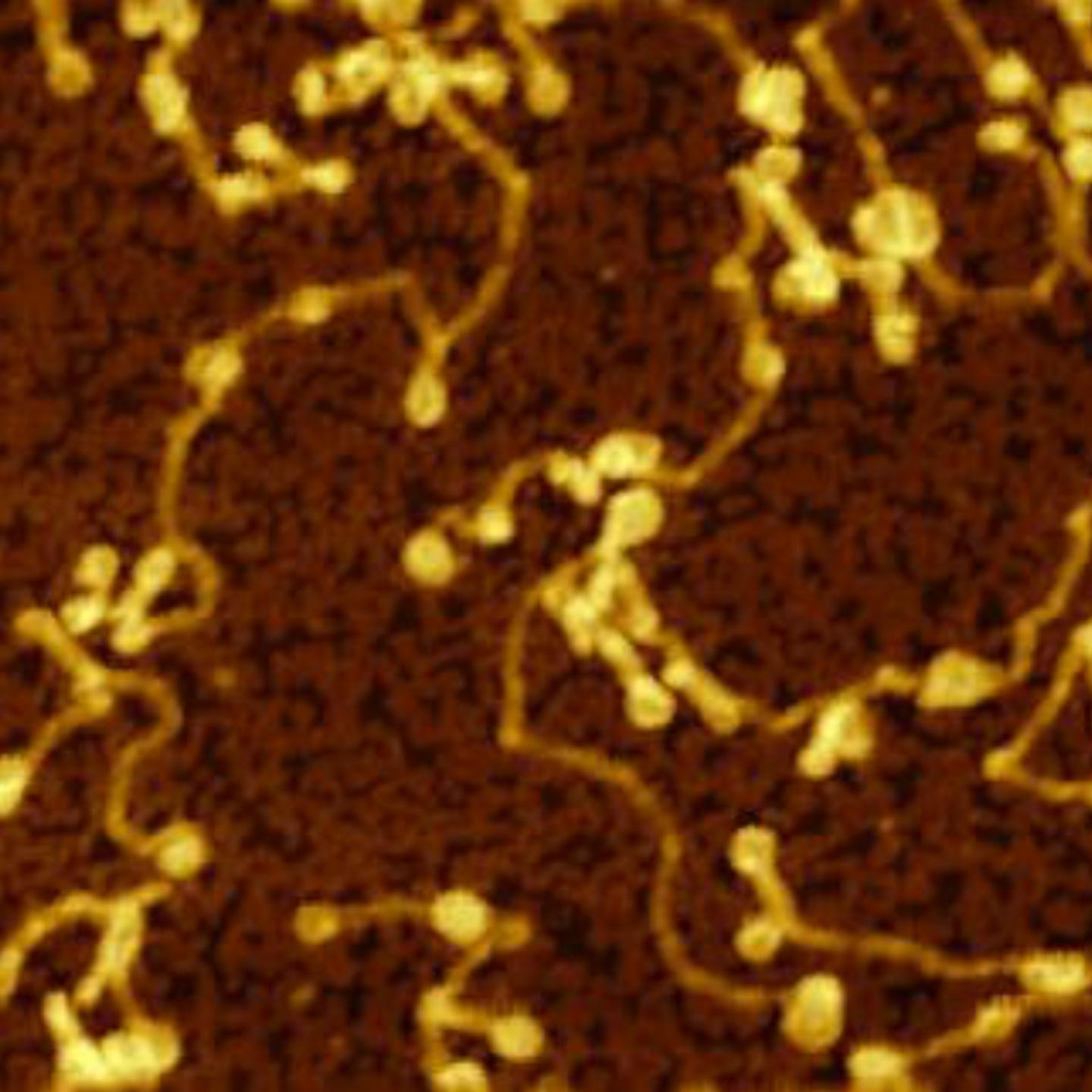 Amyloid Fibrils Detail