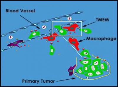 Tumor Microenvironment of Metastasis