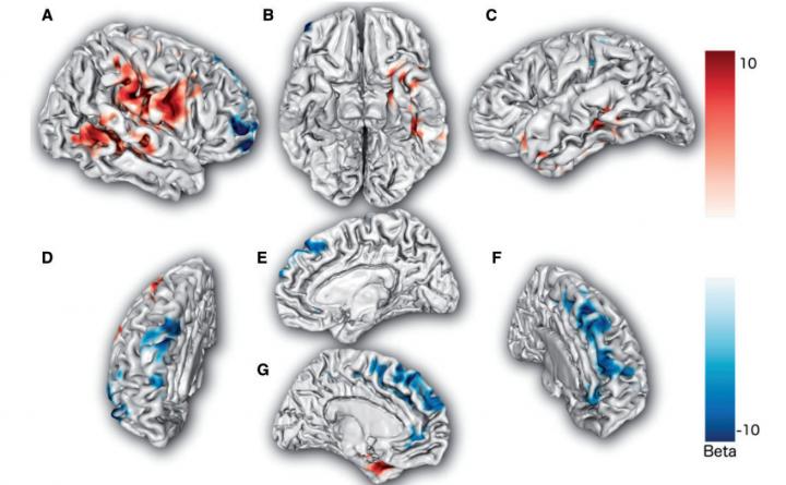 Brain Regions Associated with Punishment