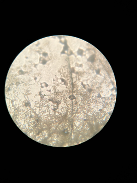 Aspergillus terreus under a microscope