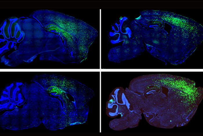 Some Autism Spectrum Disorder Symptoms Linked to Astrocytes