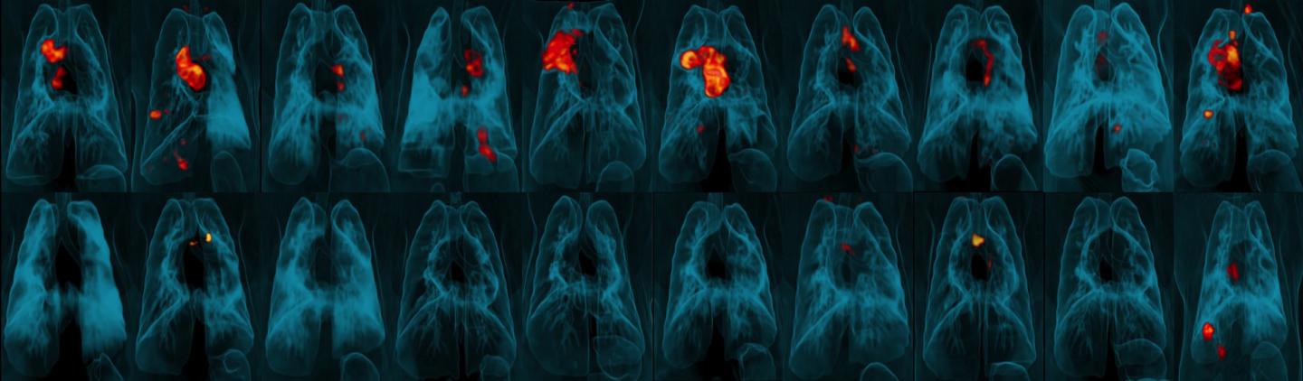 Images of Animal Lungs Showing Substantial Areas of Tb Infection or Very Little or No Infection