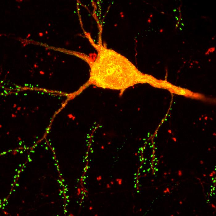 Rabies Neuron