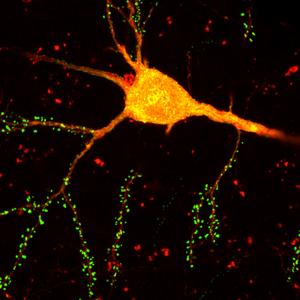 Rabies Neuron