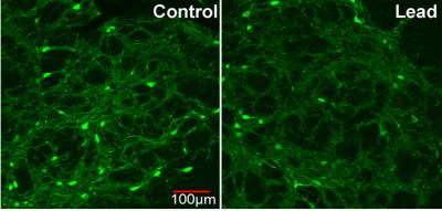 Lead Lowers Density of Neurons in Rat Brains