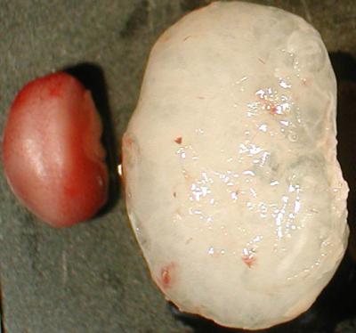 Normal and Polycystic Mouse Kidney