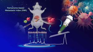 RMI-guided metastasis prediction based on single-cell Raman spectra