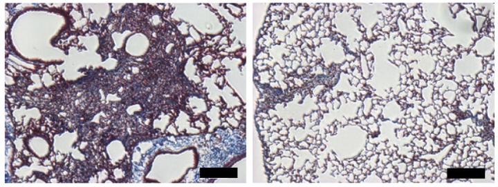 Targeting Mdm4 promotes lung fibrosis resolution