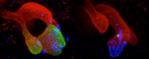 Pancreatic development in wild type mice vs. mice without PTF1A