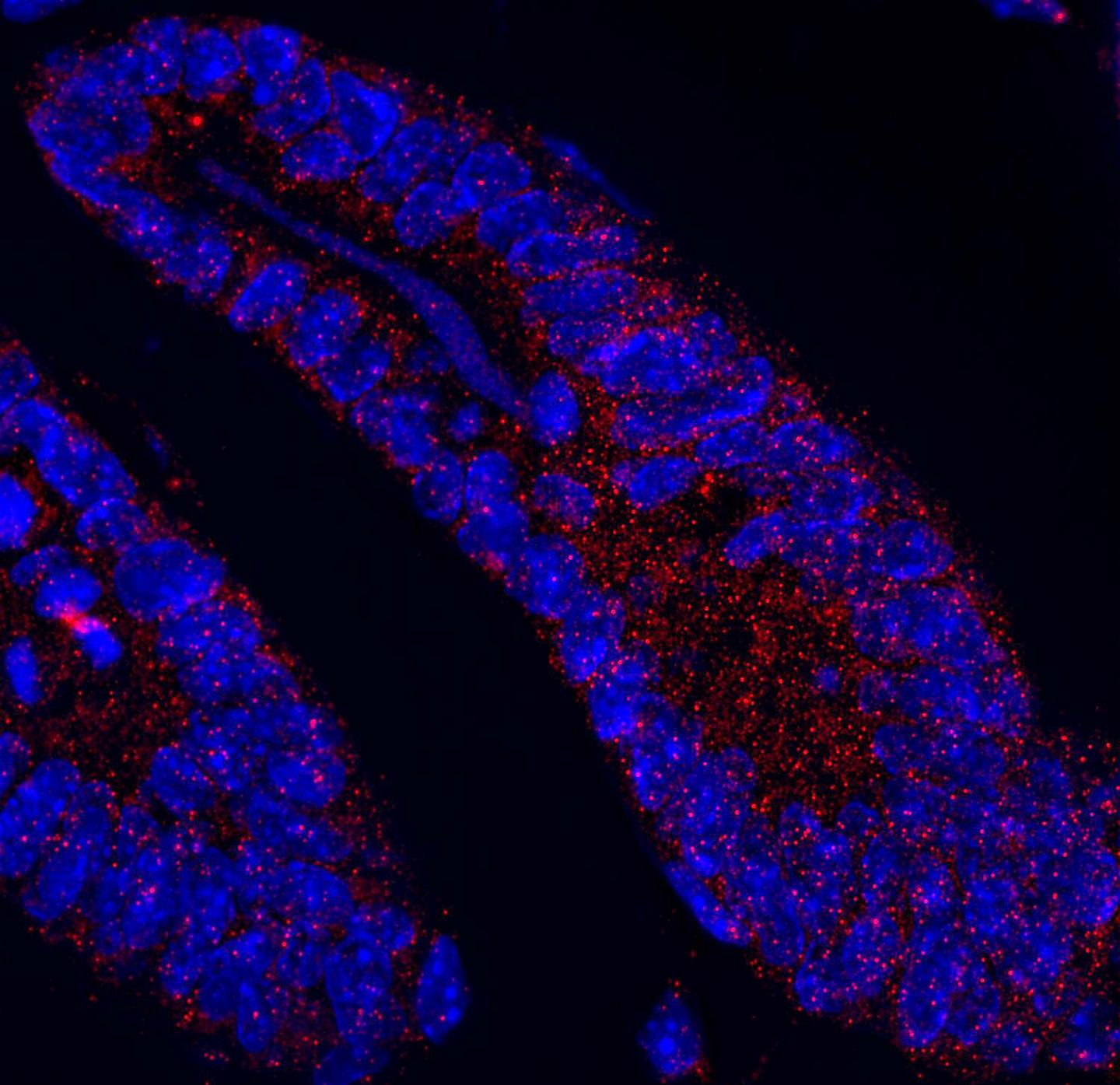 The Cell Death Regulating Protein MCL1