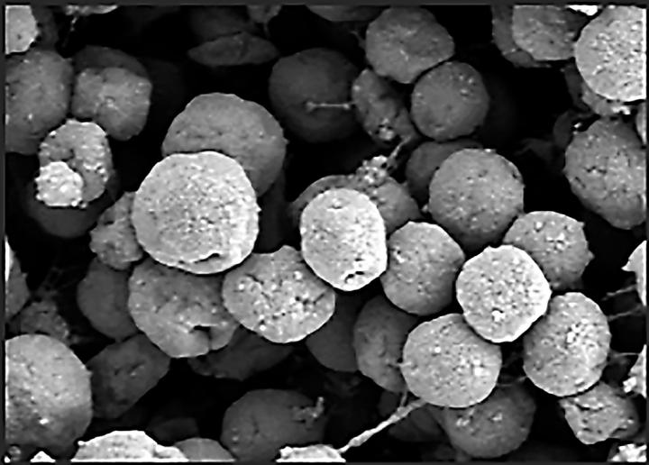 Electron Microscopic Image of Methanogens