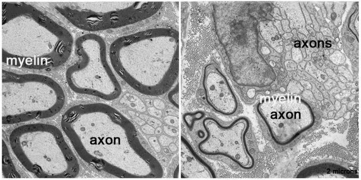 Nerves with and without Prohibitin
