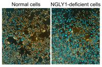 Normal Cells Compared to NGLY1-Deficient Cells Placed in Distilled Water