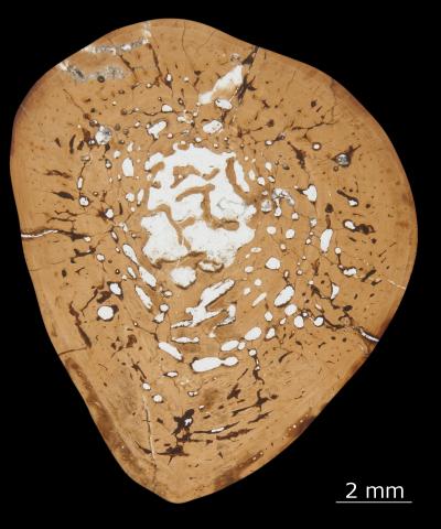 Microanatomy of the Midshaft of <i>Metoposaurus</i> Femur