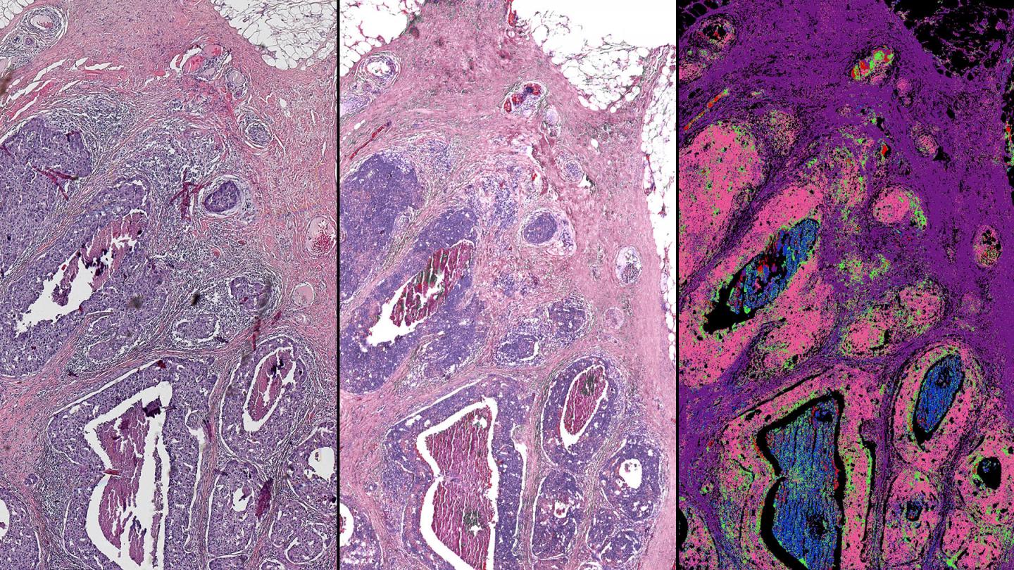 Infrared-Optical Hybrid Microscope