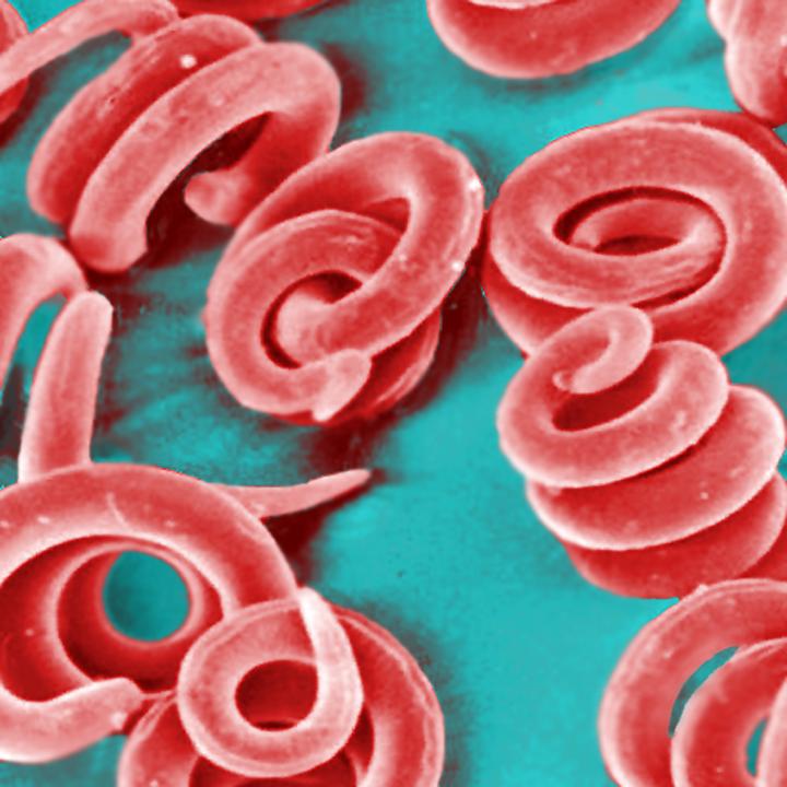 Infective <i>Trichinela spiralis</i> Larvae