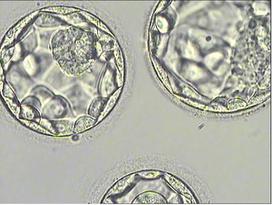IVF Embryos.