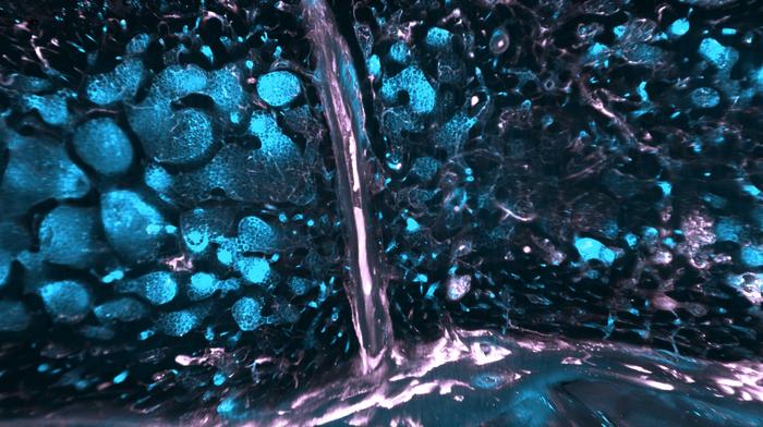 Immune cells in blue and vessels in pink in the bone marrow of the skull