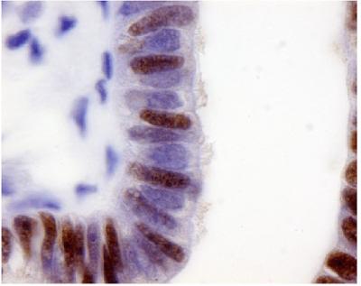 PAX8 in Healthy Fallopian Tissue