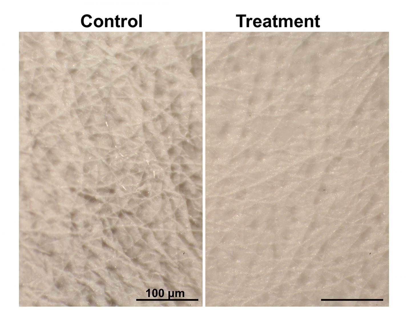 Smoothing Wrinkles in Mice -- Without Needles