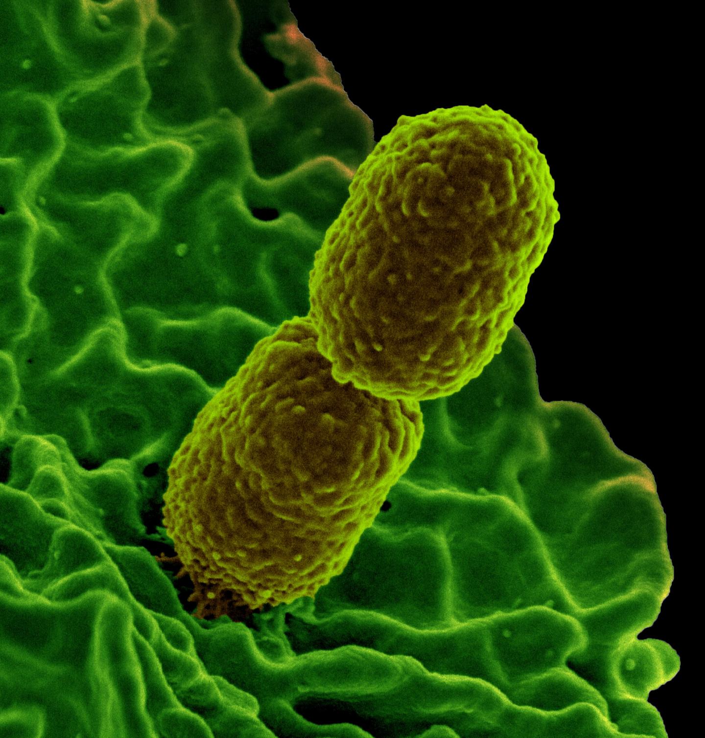 carbapenem-resistant Klebsiella pneumoniae interacting with a human neutrophil