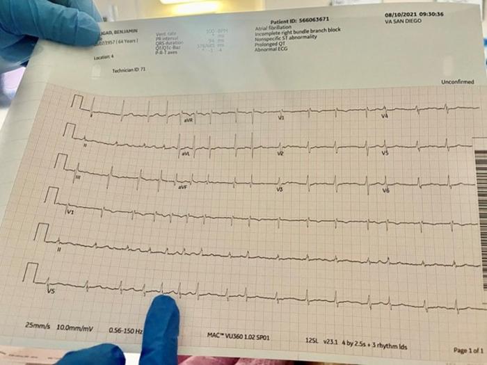 A physician reviews an EKG showing atrial fibrillation