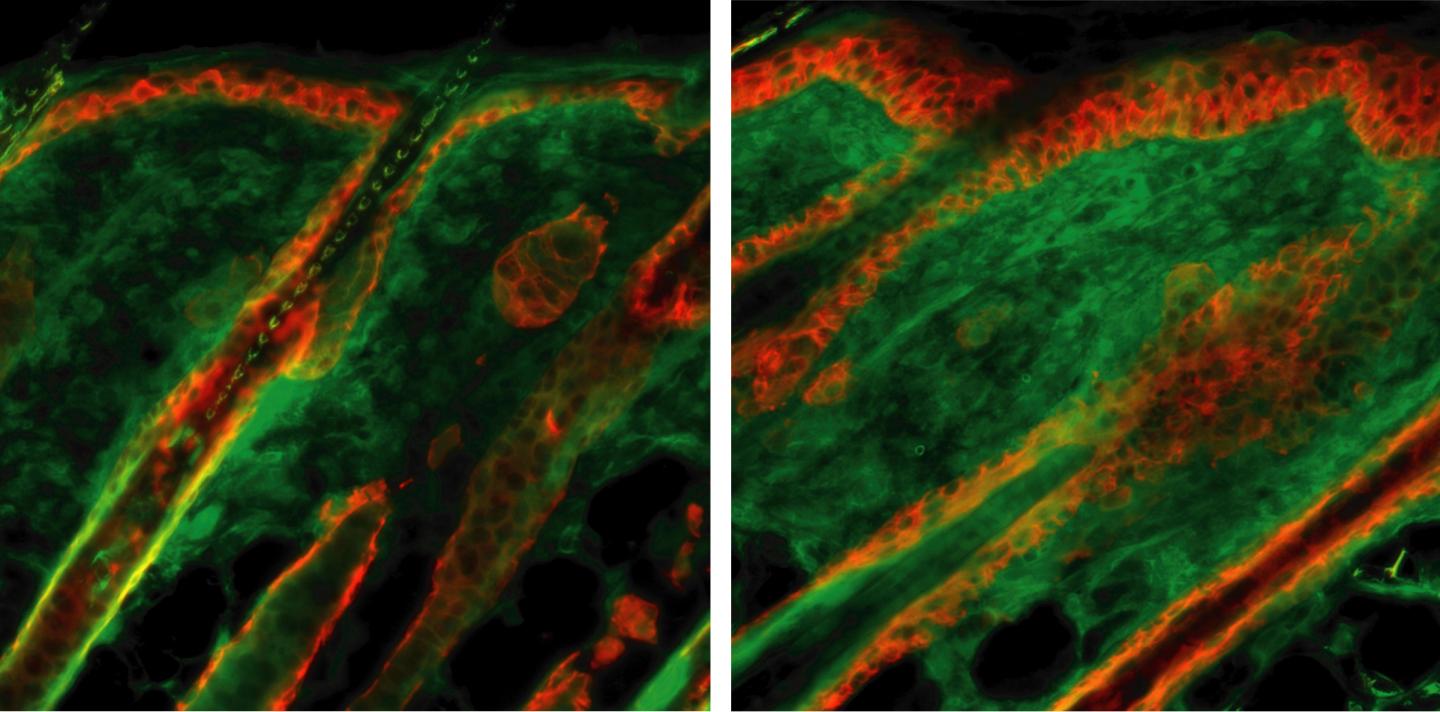 Images of Elastin in Skin Tissues