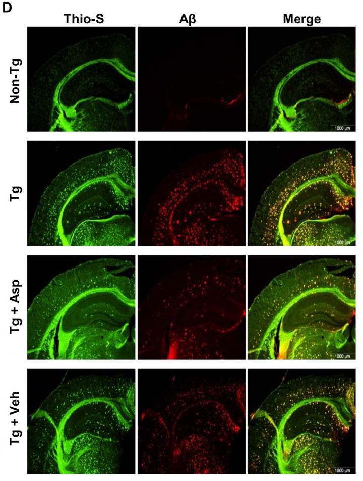 Alzheimer's & Aspirin