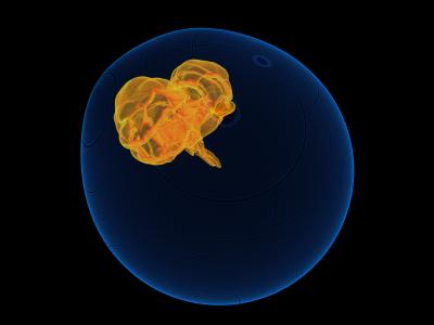 A Star Begins to Self-Destruct