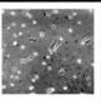 SK-N-SH Neuroblastoma Cells