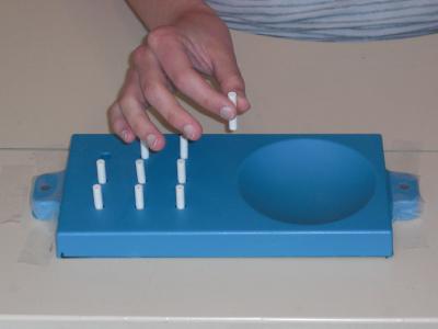 Hand Use Improved After Spinal Cord Injury with Noninvasive Stimulation (2 of 2)