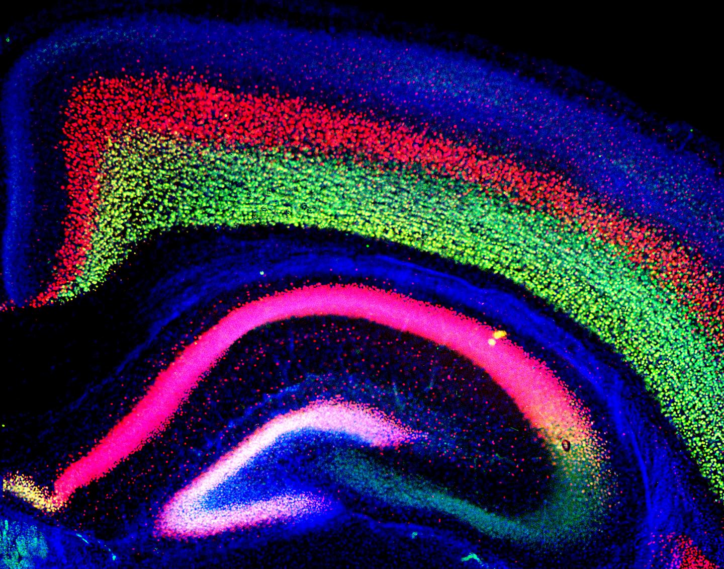 Mice Provide Insight into Genetics of Brain Development in Autism
