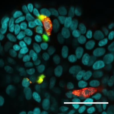 Mini-Intestine with the Hormone Motilin in Green and Red
