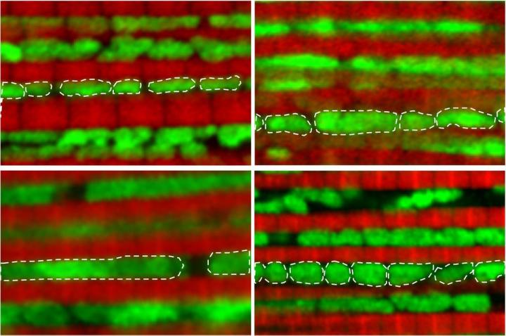 Mitochondria Intervention