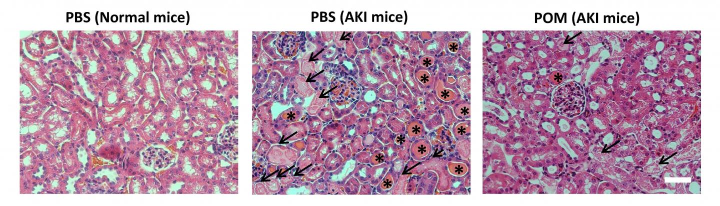 Kidney Injury Figure