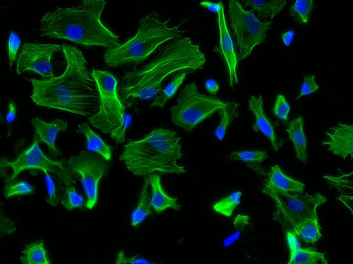 Hutchinson-Gilford Progeria Syndrome Smooth Muscle Cells