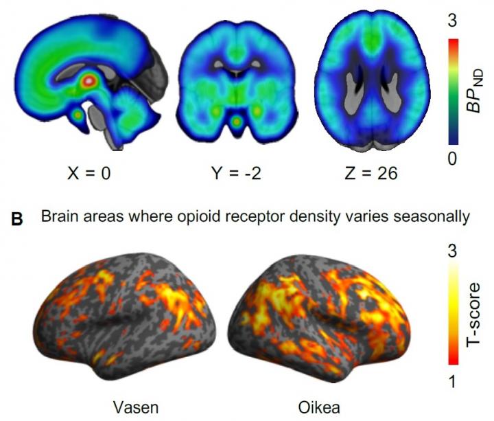 Brain opioid receptors