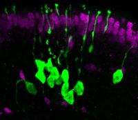 Clonal Sensory Neurons