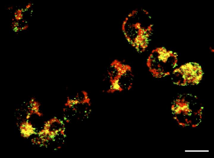 Neutrophils Isolated from SLE Patients