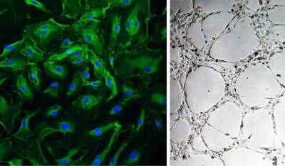 Human Endothelial Progenitor Cells