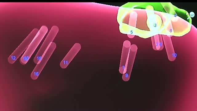 Targeted Prostate Biopsy