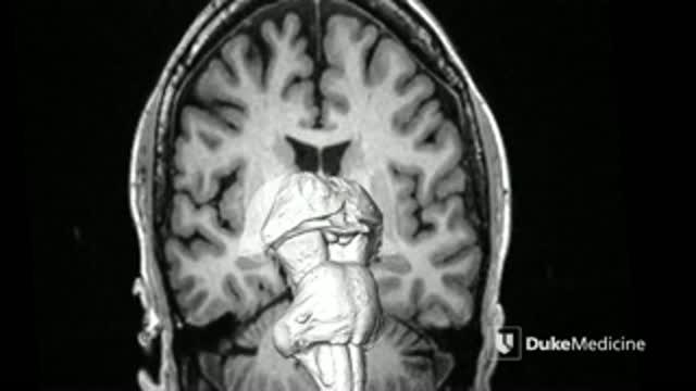 MRI Technology Reveals Deep Brain Pathways in Unprecedented Detail