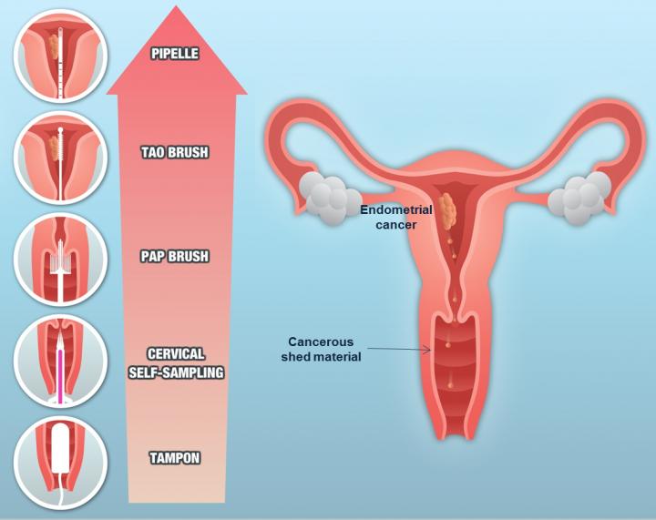 Endometrial Cancer