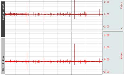 Gabapentin Intervention