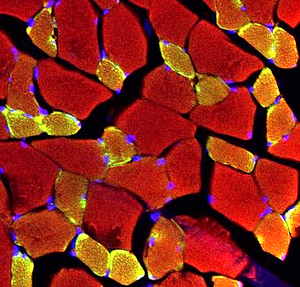 Muscle fibres taking up RBCEVs