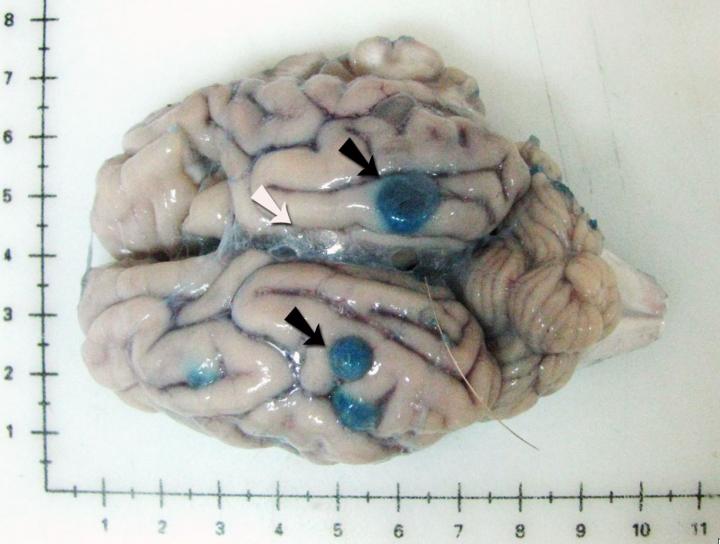 brain tapeworm