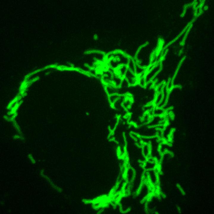 Frankenbody Mitochondria