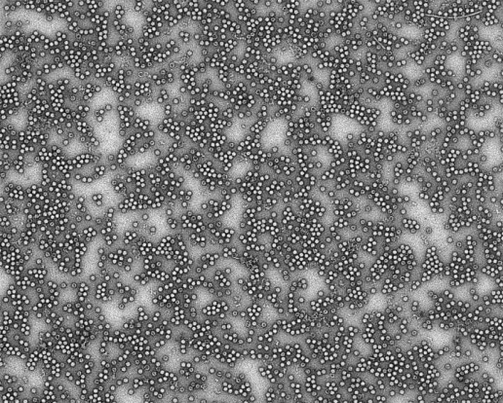Virus Particles in Coxsackievirus B3