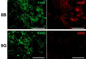 Cancer stem cells are associated with ore senescent macrophages