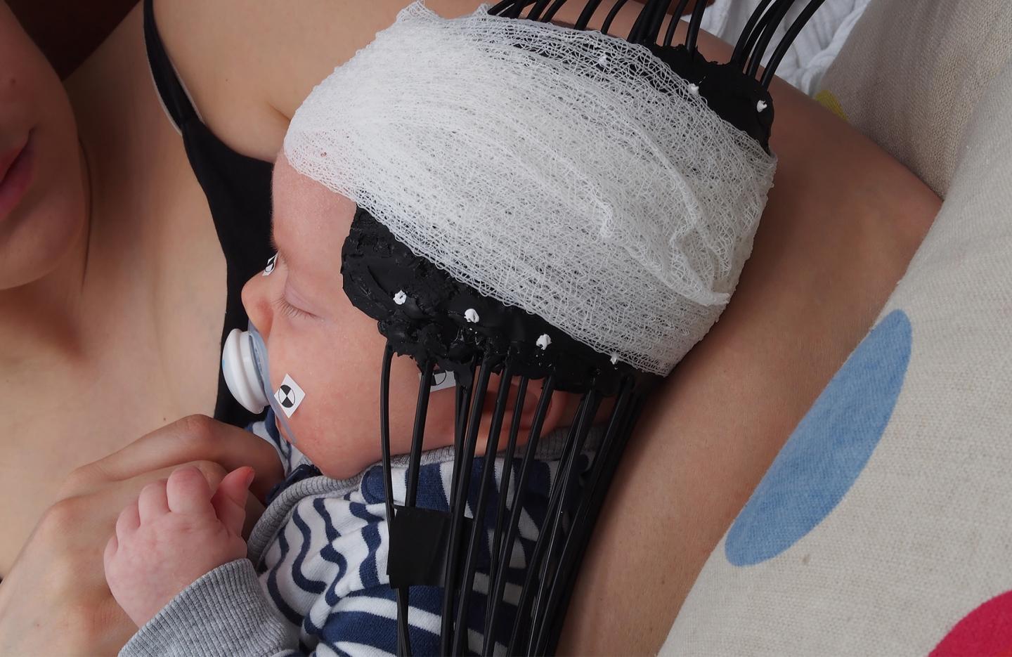 Baby Undergoing DOT Scan